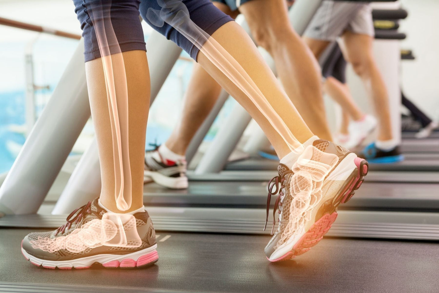 People walking on treadmills with leg and foot bones highlighted, representing bone-building nutrients and strength