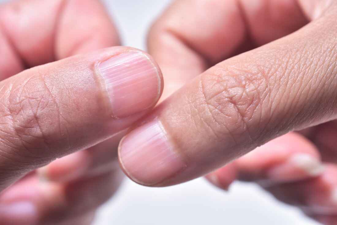 What Are the Most Common Mineral Deficiencies?