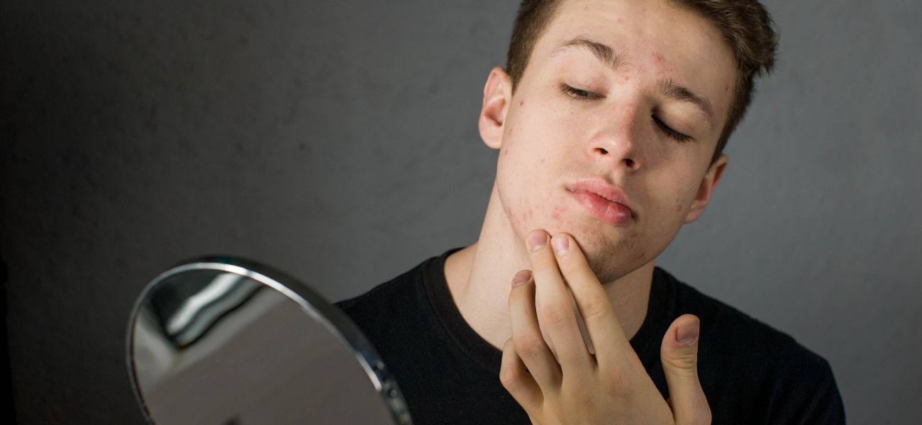 Gut Brain Skin Axis: How the Microbiome Affects Mood, Acne, and Skin Health