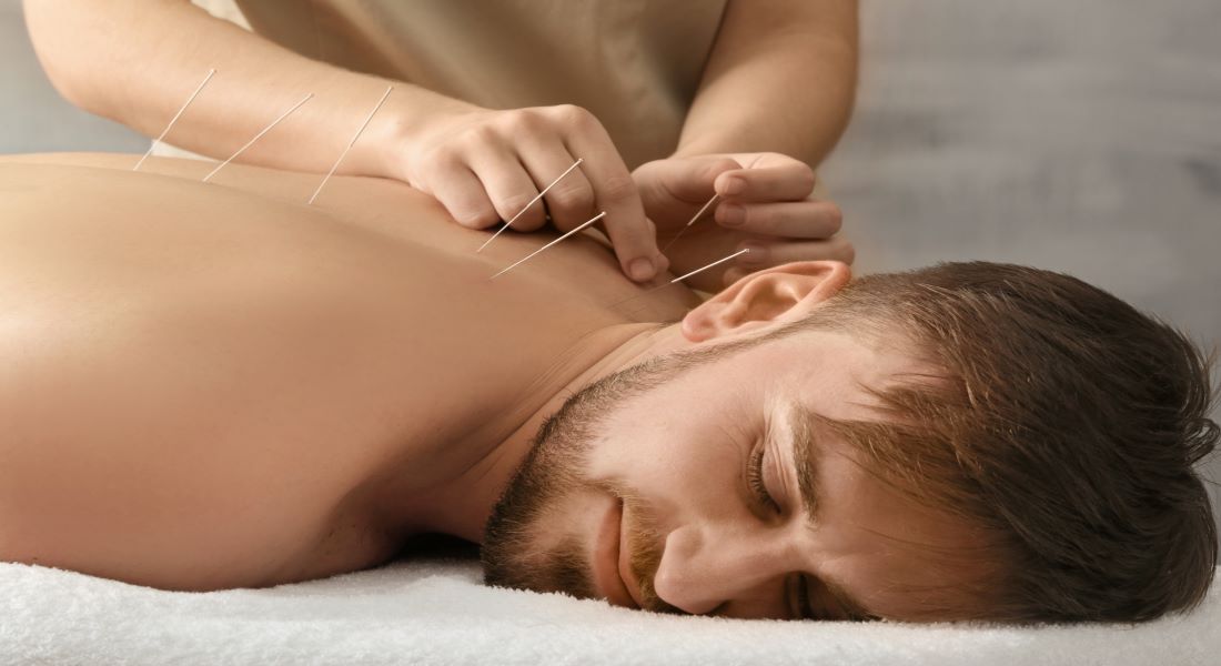 Man lying face down receiving acupuncture with needles along his back and neck