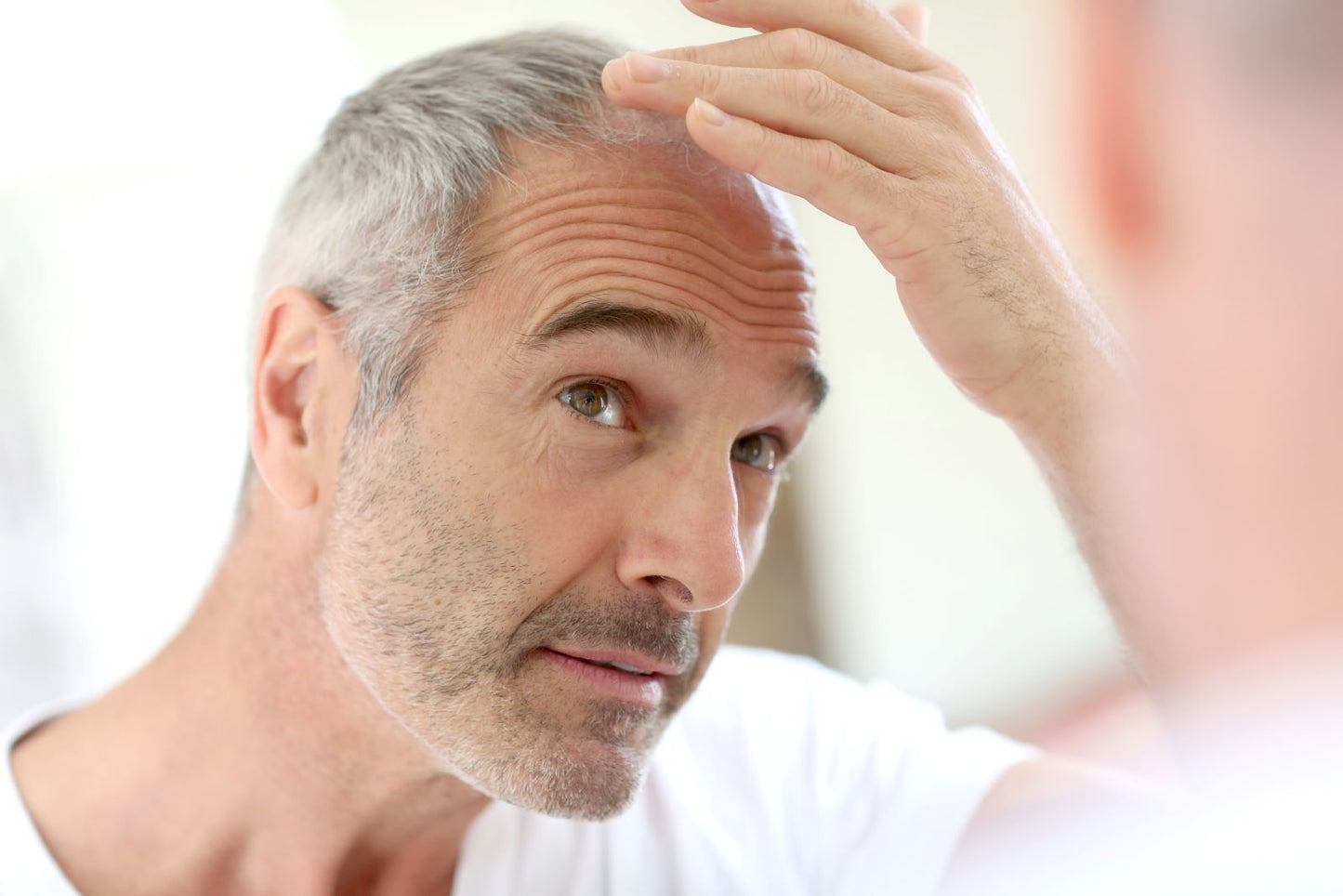 Middle-aged man examining his thinning hairline in a mirror, reflecting nutrient-related hair loss